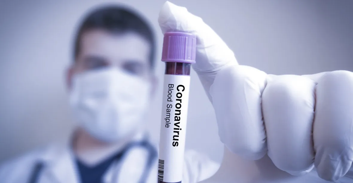 Lidé se snaží pomáhat s problémy kolem koronaviru. Organizují šití roušek či hlídání dětí
