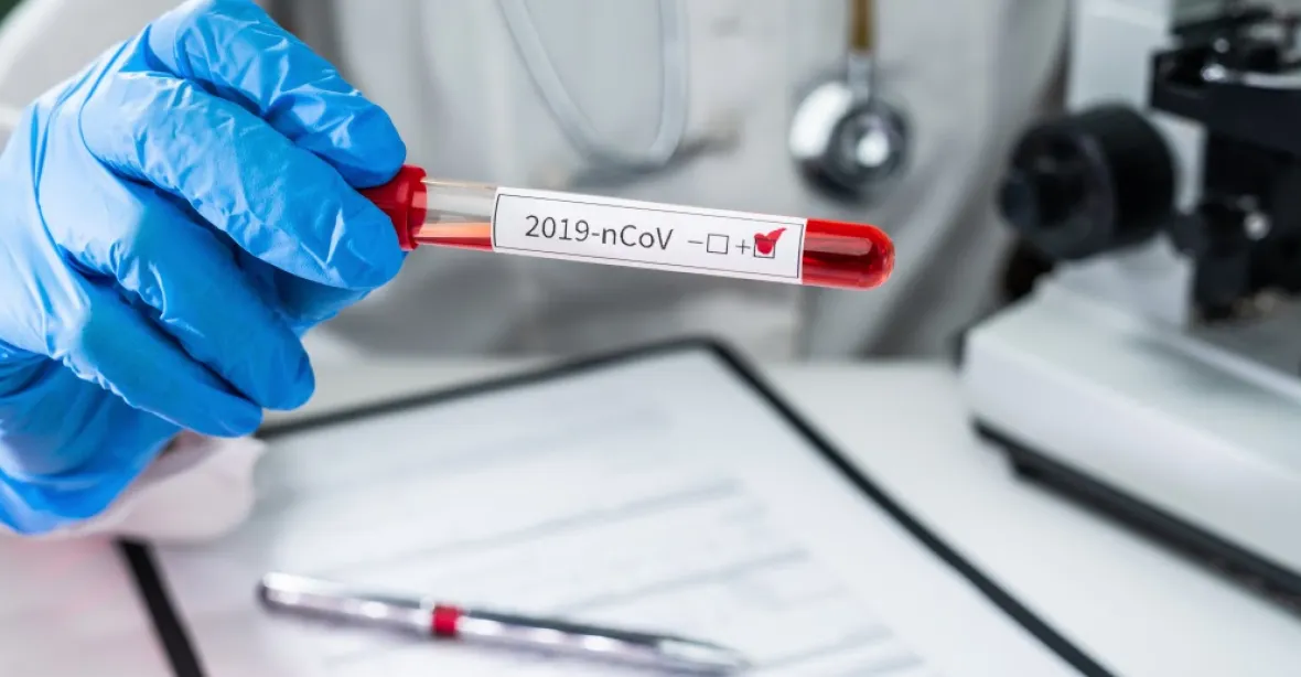 Vakcína proti covidu-19 bude nejdříve na konci roku, tvrdí český odborník