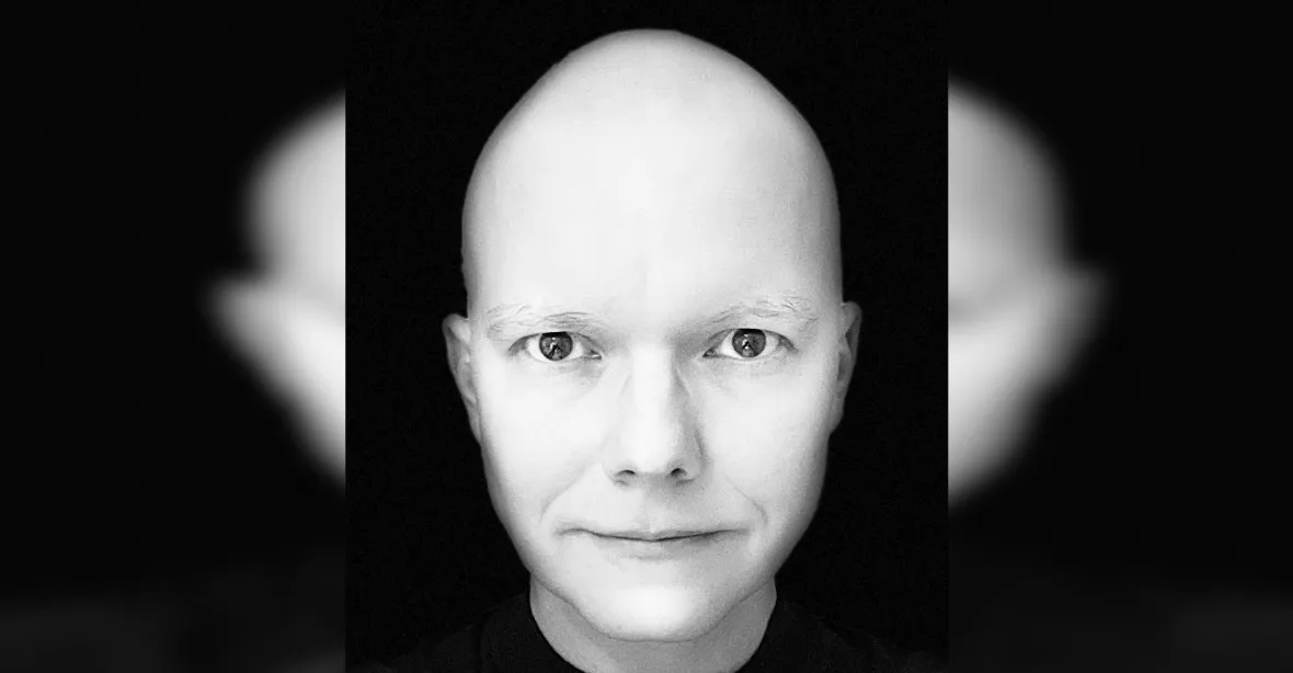 Zákeřná alopecie. Bývalému moderátorovi ČT Drahoňovskému slezly vlasy i chlupy