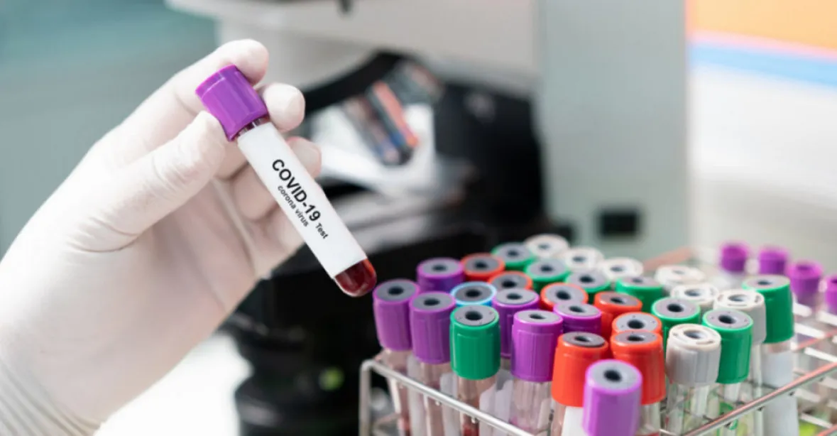 V Šanghaji se objevila nová subvarianta koronaviru. „Riziko šíření je velmi vysoké“